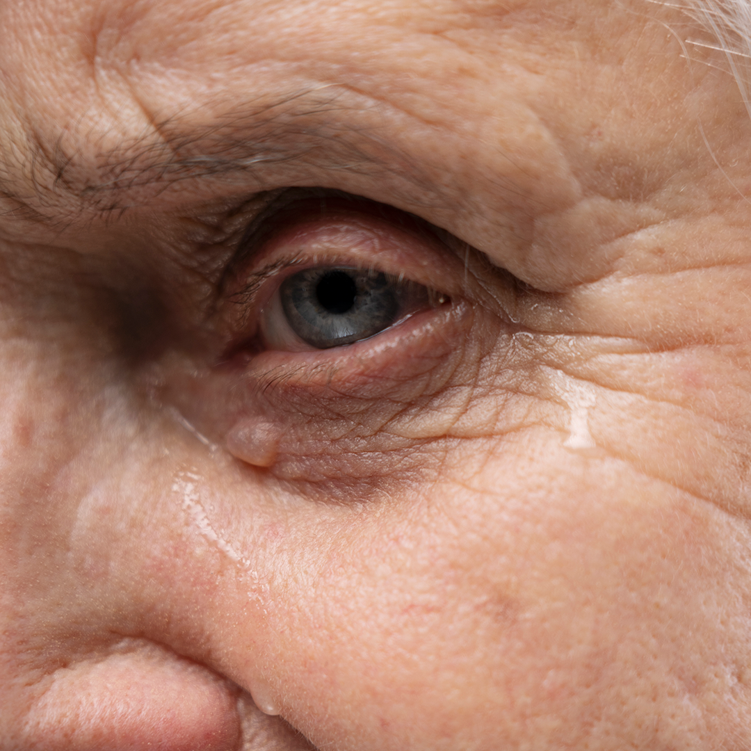 Maio Verde: Campanha alerta para a prevenção do glaucoma, principal causa de cegueira irreversível